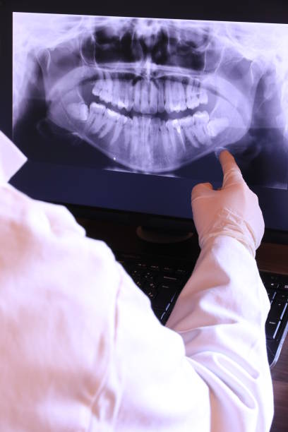 Teeth Whitening in LA